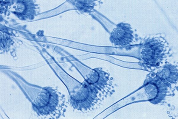 Un Aspergillus Fumigatus examiné au microscope à l'IBC de Rouen